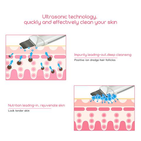 Ultrasonic Skin Scrubber Cleanser
