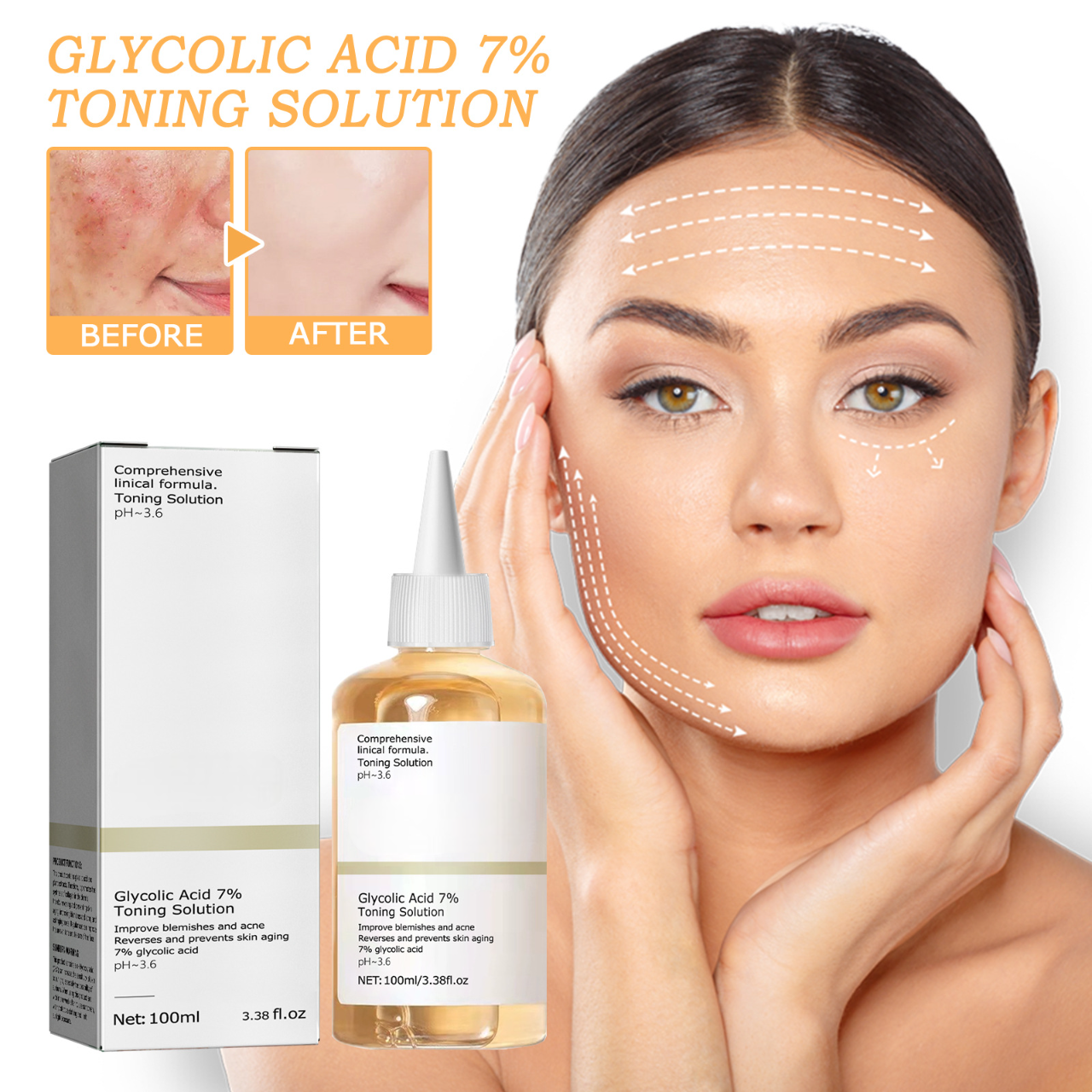Glycolic Acid Acne Lotion